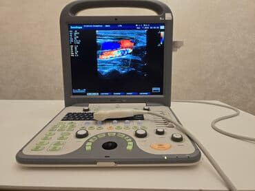 SonoScape S8 portativ ultrasəs sistemi Xüsusiyyətlər: - Rəngli lalafo.az -da SonoScape S8 portativ ultrasəs sistemi Xüsusiyyətlər: - Rəngli