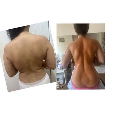 Vakuum masajı, Qadınlar üçün lalafo.az -da Vakuum masajı, Qadınlar üçün