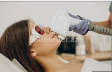 Lazer ustası tələb olunur, Faiz, 3-5 illik təcrübə lalafo.az -da Lazer ustası tələb olunur, Faiz, 3-5 illik təcrübə