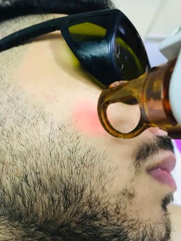 Dırnaq qurutma lampaları: Epilyasiya üçün, Aleksandrit, Təlim keçirilir lalafo.az -da — 3 Dırnaq qurutma lampaları: Epilyasiya üçün, Aleksandrit, Təlim keçirilir — 3