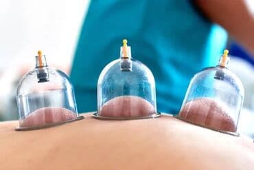 Xidmət: Qan qoyma (hijama) və elektrostimulyasiya terapiyası Təsvir lalafo.az -da Xidmət: Qan qoyma (hijama) və elektrostimulyasiya terapiyası Təsvir