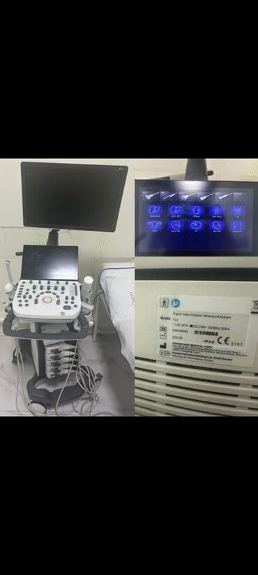 Sonoscape usm aparati 22.000azn satilir.2020 -ci il buraxılışlıdır lalafo.az -da Sonoscape usm aparati 22.000azn satilir.2020 -ci il buraxılışlıdır