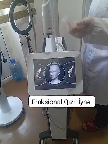 Fraksional Qızıl İynə aparatı ilə professional dəri cavanlaşdırma lalafo.az -da Fraksional Qızıl İynə aparatı ilə professional dəri cavanlaşdırma