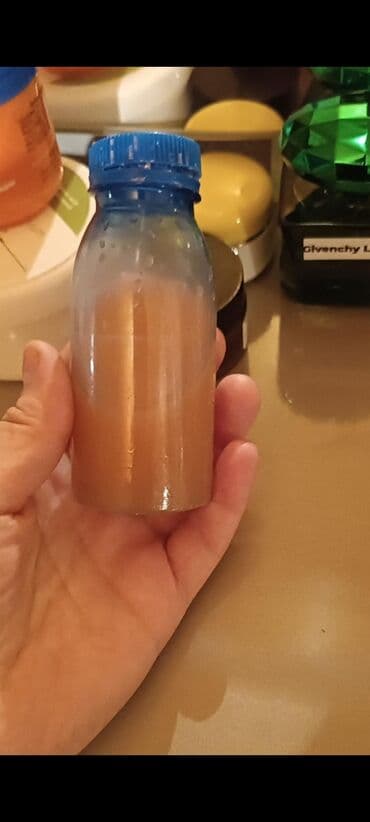 Botoks effektli masqa uzu dartir suse kimi edir qirislari aparir cox lalafo.az -da Botoks effektli masqa uzu dartir suse kimi edir qirislari aparir cox