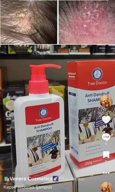 Buyur, seboriya və kəpəye qarsi sampun 1. “Kəpəyə son — sağlam və lalafo.az -da Buyur, seboriya və kəpəye qarsi sampun 1. “Kəpəyə son — sağlam və