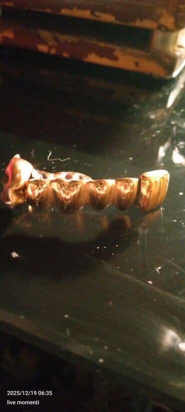 Titan diş körpüsü (üst çənə üçün segment) - Material: sarı titan lalafo.az -da Titan diş körpüsü (üst çənə üçün segment) - Material: sarı titan