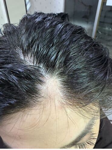 Saç üçün yağ, Saç tökülməsinə qarşı lalafo.az -da Saç üçün yağ, Saç tökülməsinə qarşı