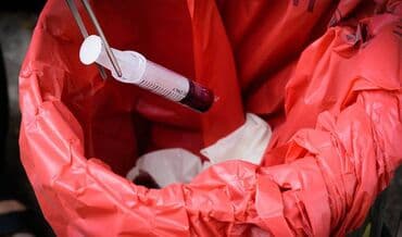 Tibbi tullantılar üçün xüsusi hazırlanmış möhkəm və təhlükəsiz lalafo.az -da Tibbi tullantılar üçün xüsusi hazırlanmış möhkəm və təhlükəsiz