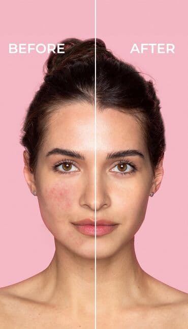 Üz kremi, 15 ml, Yeni, Pulsuz çatdırılma lalafo.az -da Üz kremi, 15 ml, Yeni, Pulsuz çatdırılma