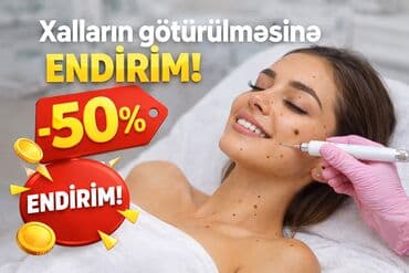 Xalların götürülməsi – 50% endirim! - Xalların (bənövşə, nevus) lalafo.az -da Xalların götürülməsi – 50% endirim! - Xalların (bənövşə, nevus)