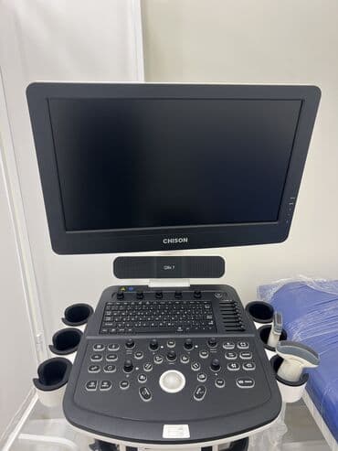 Медицинские лампы: CHISON rəqəmsal ultrasəs aparatı “Tam yeni, qutudan yalnız çıxarılmış at lalafo.az — 3 Медицинские лампы: CHISON rəqəmsal ultrasəs aparatı “Tam yeni, qutudan yalnız çıxarılmış — 3