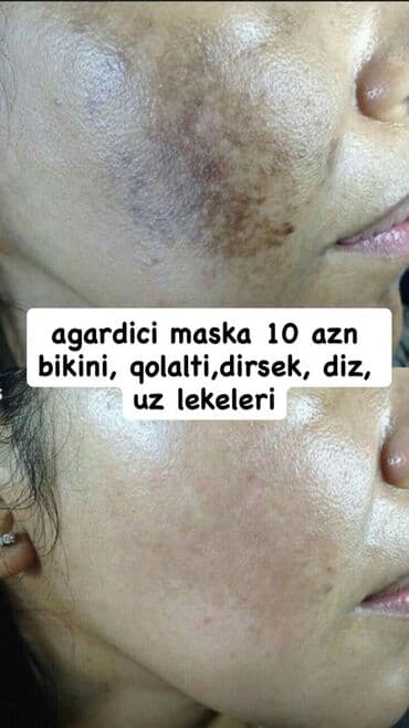 Üz kremi, Bütün dəri növləri üçün, Yeni, Pulsuz çatdırılma lalafo.az -da Üz kremi, Bütün dəri növləri üçün, Yeni, Pulsuz çatdırılma