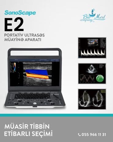 Model: Sonoscape E2 İstehsalçı: SonoScape Medical Corp (Çin) Tip lalafo.az -da Model: Sonoscape E2 İstehsalçı: SonoScape Medical Corp (Çin) Tip